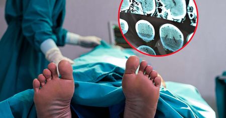 Polska w ogonie Europy pod względem transplantacji. Lekarze wskazują główne powody