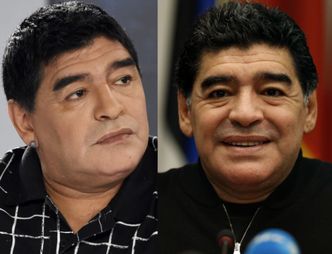Maradona po OPERACJI PLASTYCZNEJ TWARZY! Poznajecie?