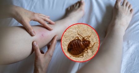 Są prawdziwą plagą w hotelach. Jak rozpoznać ugryzienia pluskwy?