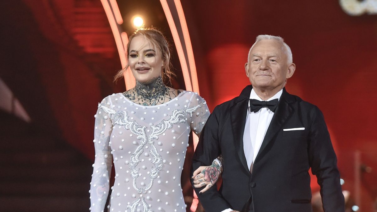 Monikę Miller czeka przeszczep włosów