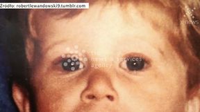 Robert Lewandowski kończy 26 lat. Zobacz jak się zmieniał