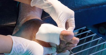 Octenilin żel – właściwości, działanie, wskazania i przeciwwskazania