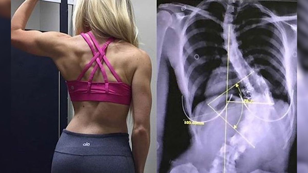 Trenerka nie zgadza się na operację