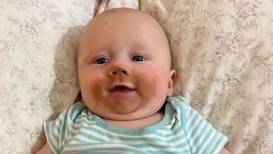 Karminie piersią po samoopalaczu