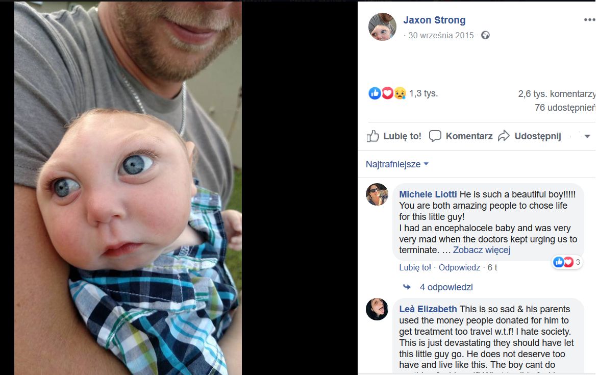 Każdą relację rodziców Jaxona śledziło kilka tysięcy osób (Facebook)