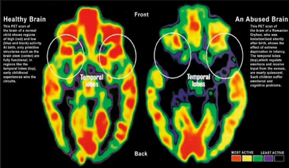 Jak rozwija się mózg dziecka?