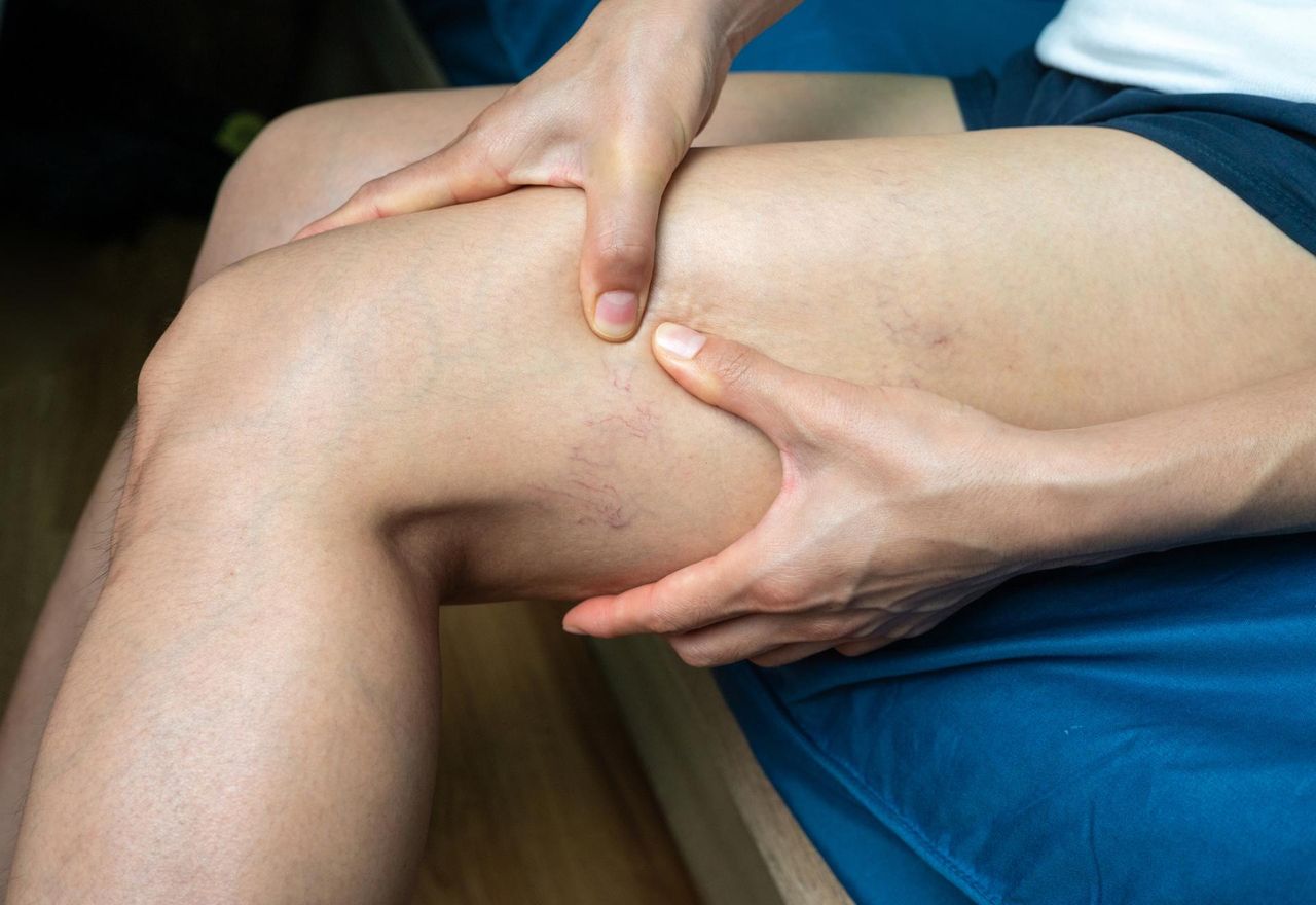 Obwód uda może świadczyć o ryzyku zgonu? Naukowcy wiedzą, ile cm to minimum