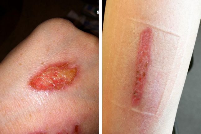 Młodzi ludzie chwalą się efektami wyzwania na portalach społecznościowych 