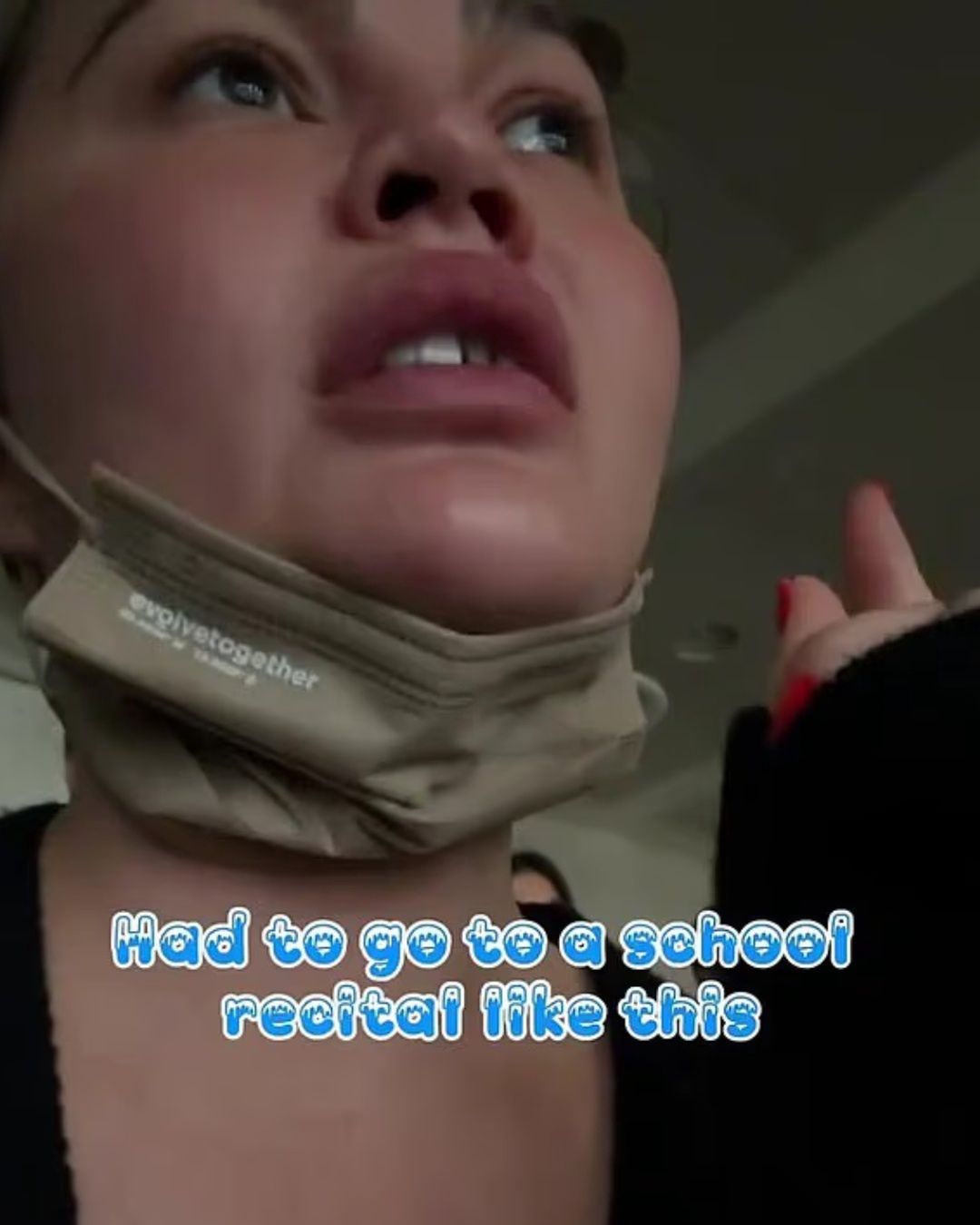 Chrissy Teigen ukruszyła sobie zęba