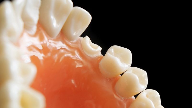 Czesi wybierają polskich dentystów