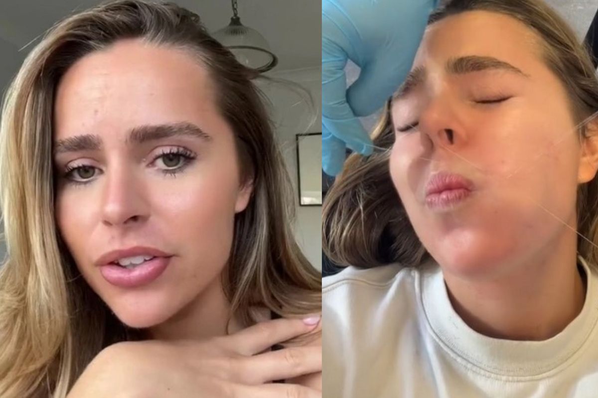 Bold TikTok influencer opens up about battling PCOS, hirsutism and online criticism