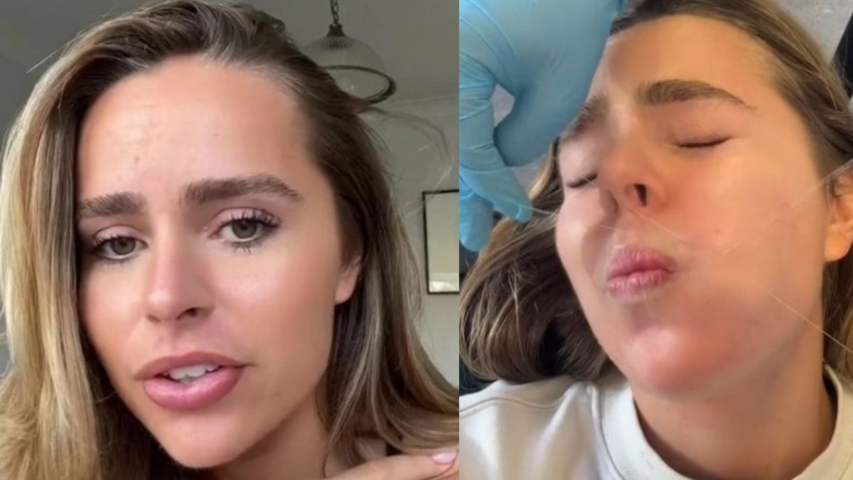 Cierpi na nadmierne owłosienie