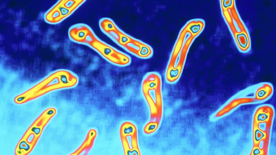 SPL stock
PHOTO: EAST NEWS/SCIENCE PHOTO LIBRARY 
Diphtheria bacillus. False-colour transmission electron micrograph of  
Corynebacterium diphtheriae the causative agent of diphtheria. Diphtheria is an  
acute infection, normally of the throat, contracted from contact with a carrier  
by air- bourne infection. The bacillus affects an area of mucous membrane,  
causing the tissue to swell. The danger to the patient is two-fold: the swelling  
may form an obstruction to breathing, and the bacillus secretes a toxin which  
passes into the blood. The toxin may cause failure of the kidneys, heart muscles  
or local paralysis. Treatment is with an antitoxin; prevention is by  
immunization. Magnification x20, 000 at 6x4. 5cm size.
ALFRED PASIEKA