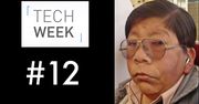 Tech Week #12: Apple Watch, wysypka i chińska maszyna do pobierania spermy