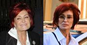 Wychudzona Sharon Osbourne snuje się po ulicach Hollywood, eksponując wielkie usta. 72-latka zmieniła się nie do poznania