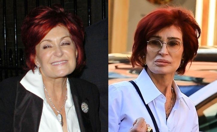 Wychudzona Sharon Osbourne snuje się po ulicach Hollywood, eksponując wielkie usta. 72-latka zmieniła się nie do poznania