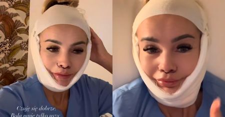 Nowy rok, nowa Monika Chwajoł. Sprawiła sobie LIFTING TWARZY i to wcale nie w Turcji