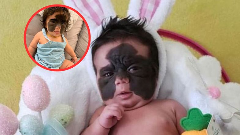 Tak dziś wygląda dziewczynka, którą nazywali "Batmanką"