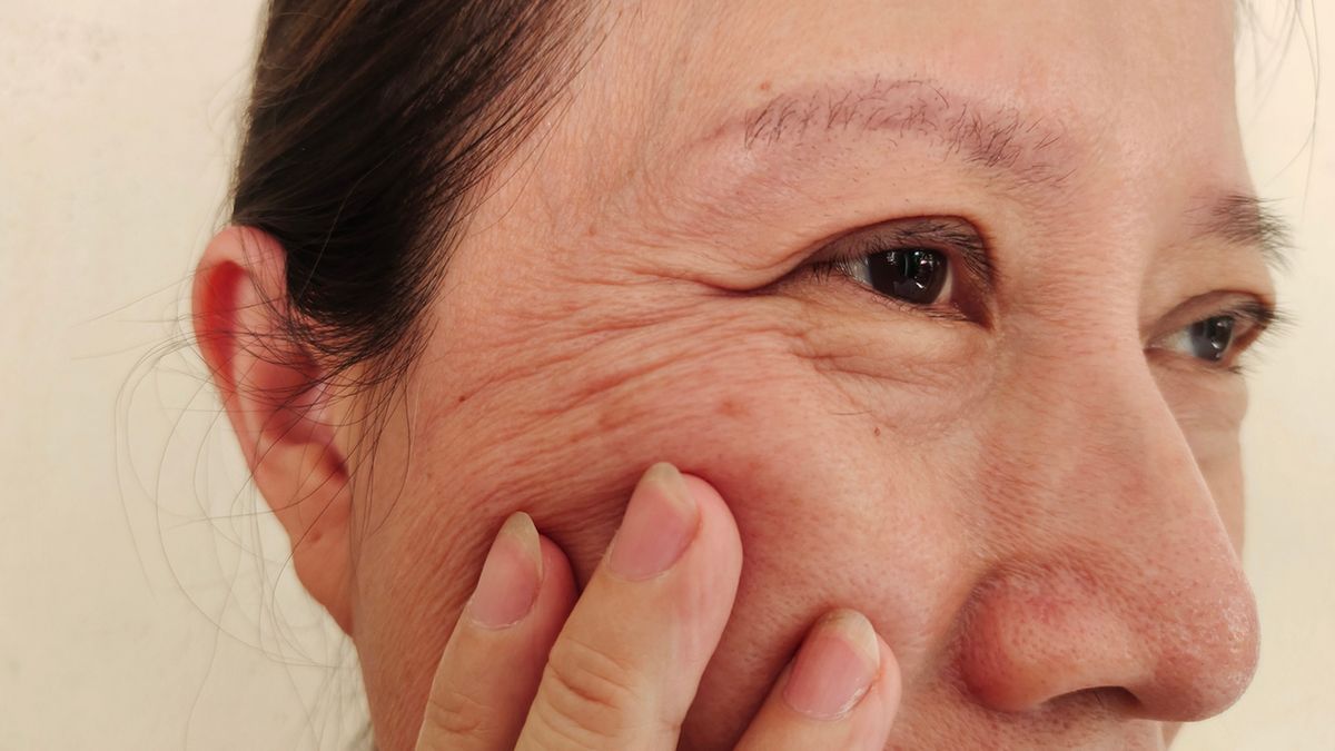 Wolne rodniki przyspieszają proces starzenia się skóry