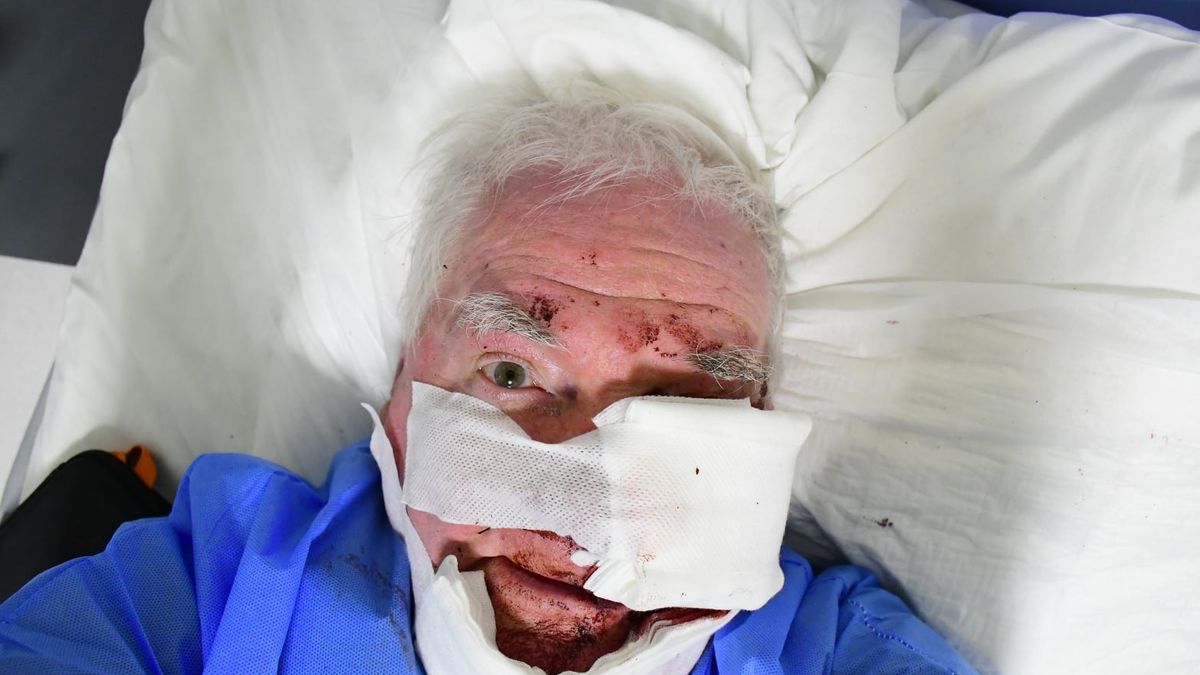 Fotoreporter postrzelony podczas Marszu Niepodległości 