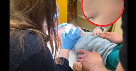 Nawet pielęgniarka myślała, że to pieprzyk. Nimfy kleszcza można łatwo pomylić