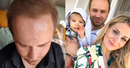 Adrian ze "Ślubu od pierwszego wejrzenia" zafundował sobie PRZESZCZEP WŁOSÓW: "W początkowej fazie jest ich mniej niż przed zabiegiem"