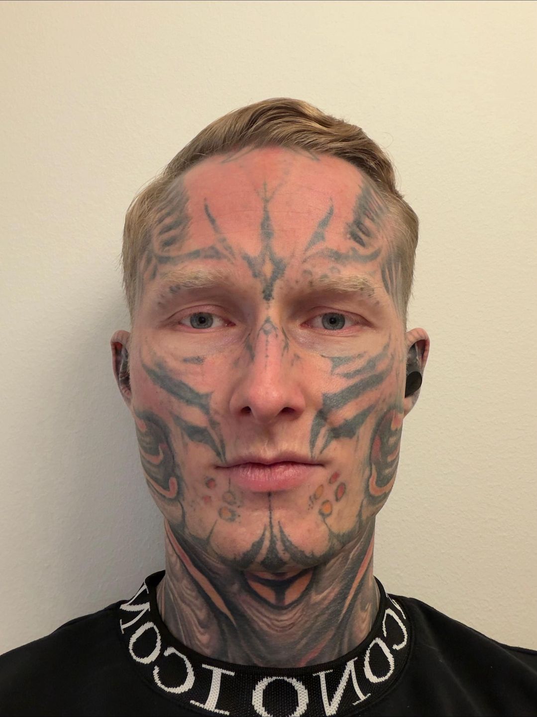 Tristan Weigelt po roku usuwania tatuaży