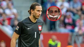 Grabara pokazał zdjęcie ze szpitala. "Z zupełnie nowym nosem"