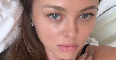 Joanna Opozda pokazała spuchniętą nogę: "Jestem lekko SPANIKOWANA"