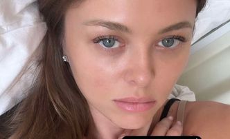 Joanna Opozda pokazała spuchniętą nogę: "Jestem lekko SPANIKOWANA"