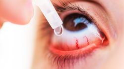 Dwa rodzaje kropli do oczu wycofane ze sprzedaży: Timo-Comod i Allergo-Comod. Jeden z produktów był popularny wśród alergików