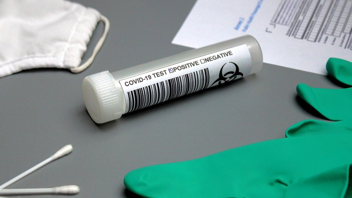 Za fałszywy test dziennikarz zapłacił równowartość 150 zł - 