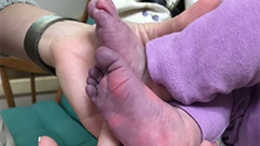 Przerażające objawy COVID-19