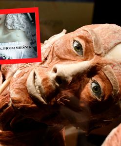 Doktor Frankenstein i plastynacja