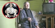 Lekarze nie mogli uwierzyć. 91-latka miała w brzuchu 60-letnie "dziecko"