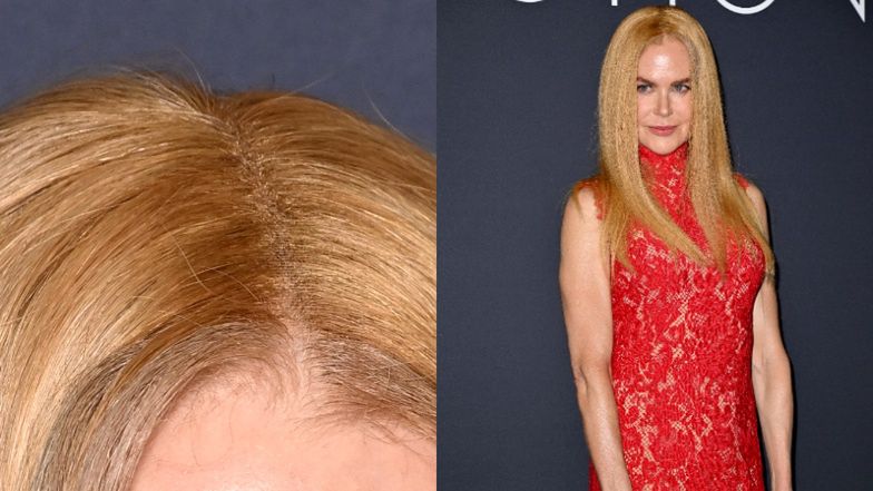 Nicole Kidman