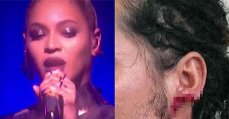 Fani tną się "dla Beyonce"! Ranią sobie uszy... (FOTO)
