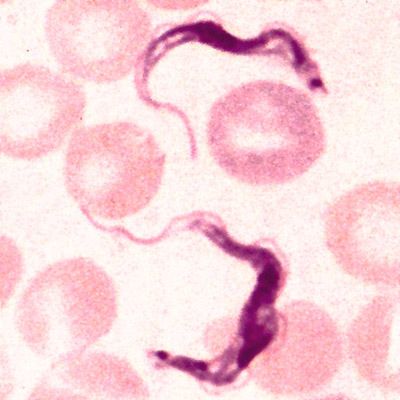 6 niezwykłych teorii i metod leczenia, które nawet działają! [TOP] 4