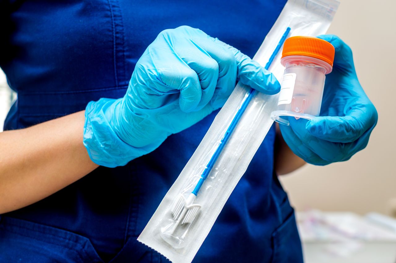 Koniec cytologii na NFZ. Zmiany już od 1 sierpnia