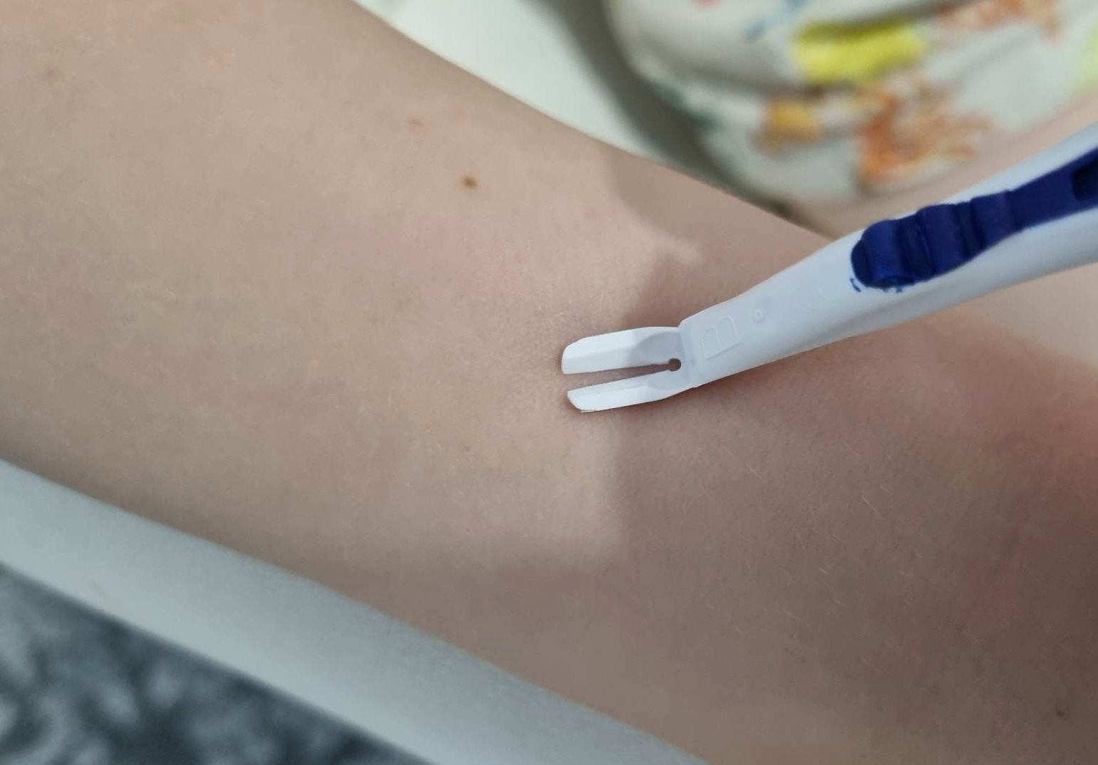 Kleszczołapki do usuwania kleszczy