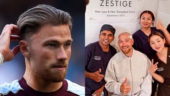 Matty Cash pochwalił się PRZESZCZEPEM WŁOSÓW (FOTO)