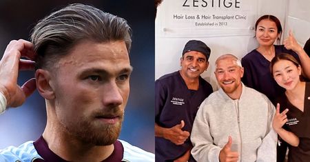 Matty Cash pochwalił się PRZESZCZEPEM WŁOSÓW (FOTO)