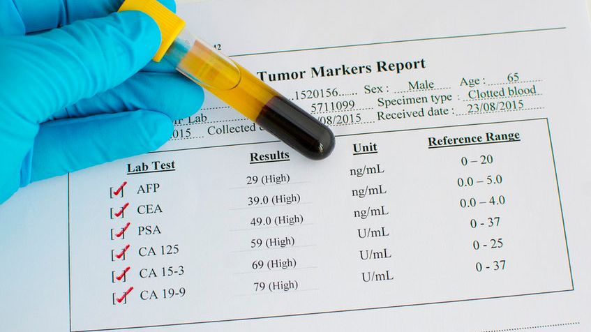 Markery nowotworowe to rodzaj specyficznych substancji, obecnych u osób cierpiących na choroby nowotworowe