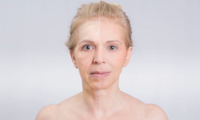 Chirurgia plastyczna: przykra prawda o zdjęciach „przed” i „po”