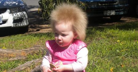 Dziewczynka z włosami jak Einstein ma już 12 lat. Jak dziś wygląda?