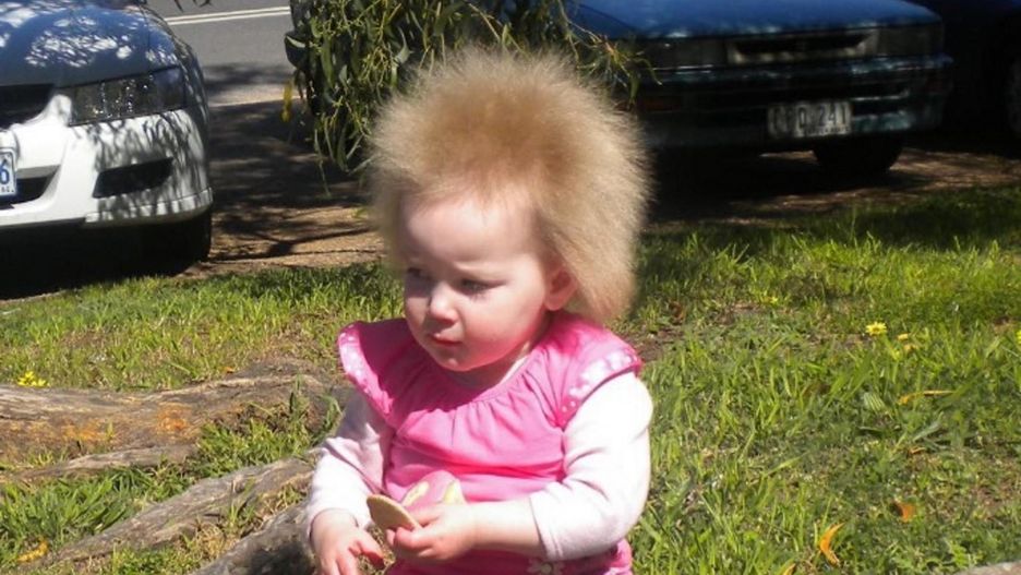 Dziewczynka z włosami jak Einstein ma już 12 lat