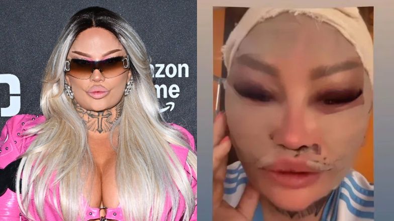 Laluna pokazała odmienione lico 10 dni po operacji