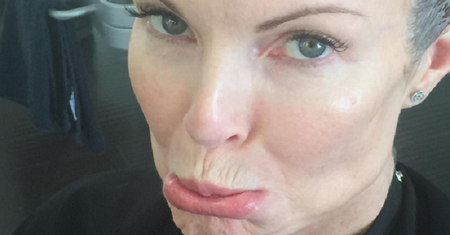 Marcia Cross wygrała z rakiem odbytu. Aktorka przyznała się fanom do choroby