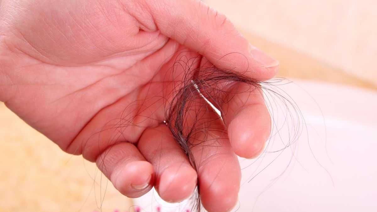 wypadanie włosów