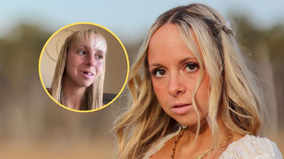 25-latka nie ma przednich zębów